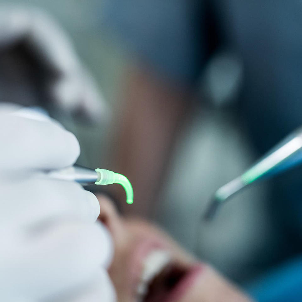 Hilfe bei Periimplantitis